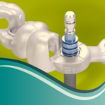 I11-Guías Quirúrgicas (Cirugías de Implantes dentales)