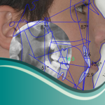 I12-Estudios Cefalometricos