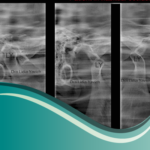 I13-Laminografia (Tomo 2D)