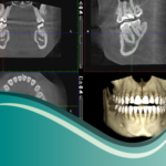 I1-Tomografías (Cone Bean)