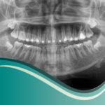 I2 - Radiografias Panoramicas